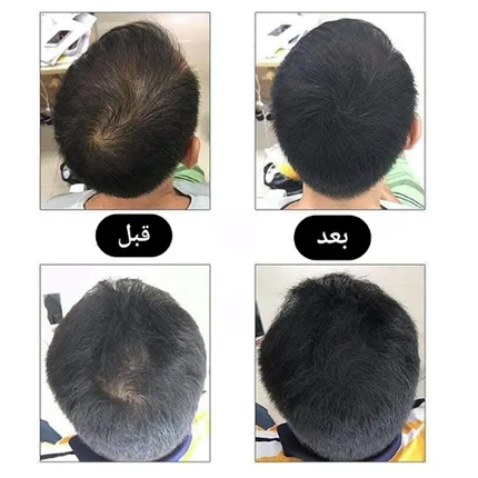 بخاخ يعمل على التعبئة والتخلص من فراغات الشعر سعة 100 مل ماركة GIOIPLUS
