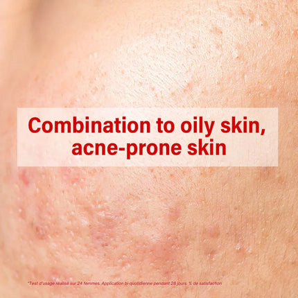 ACM SEBIONEX TRIO المضادة للإمثاق الكريمة 40 مل